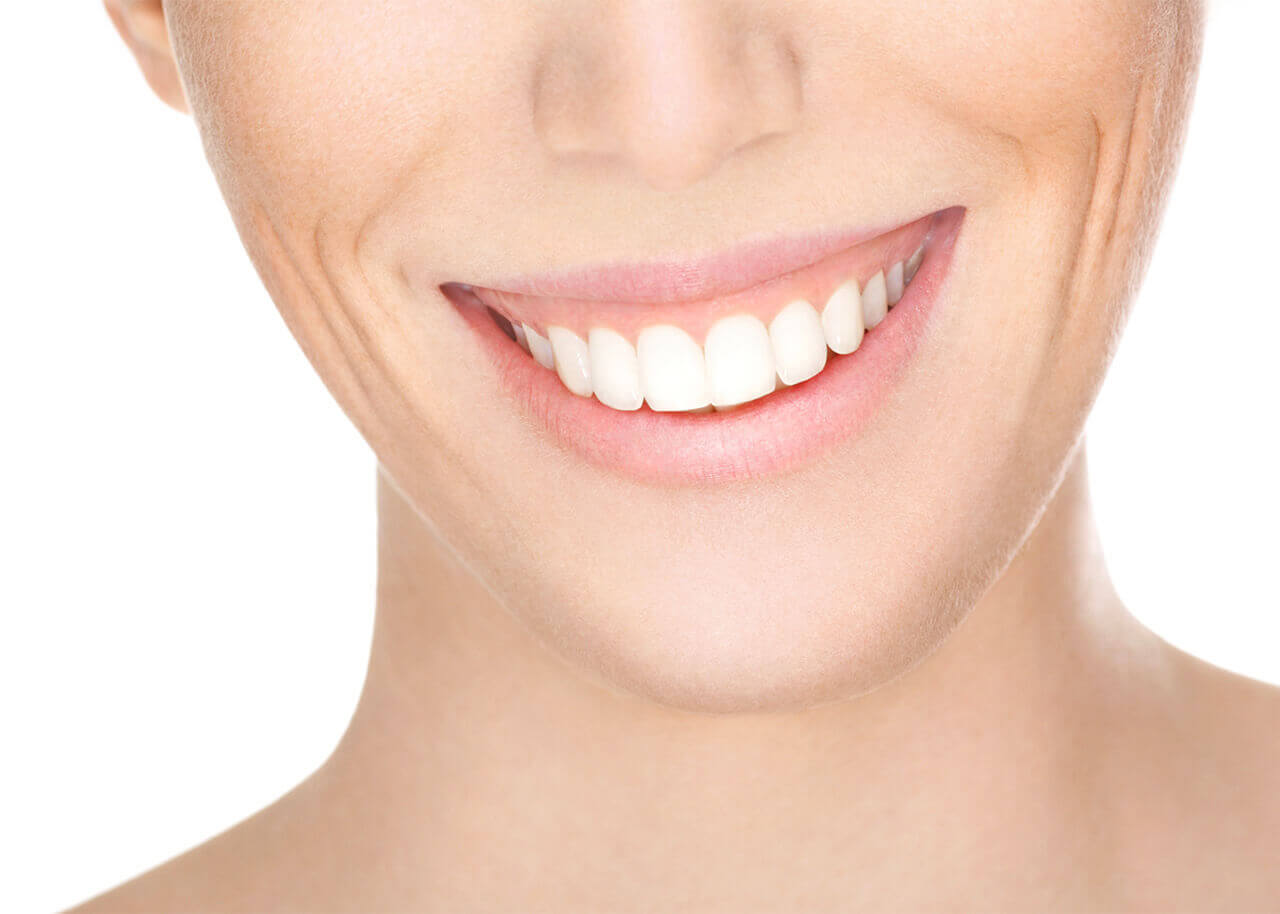 Gummy-smile
