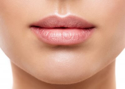 Lip Augmentation