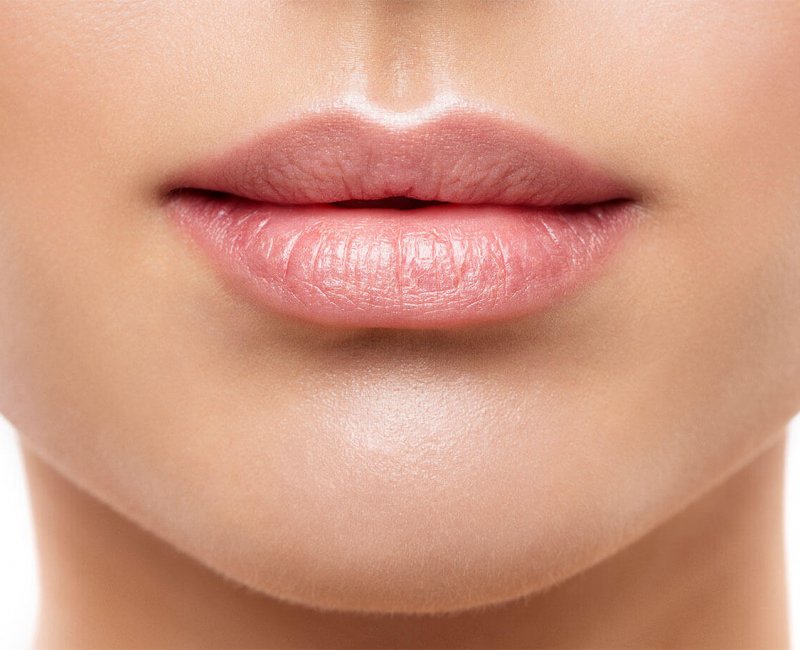 Lip Augmentation