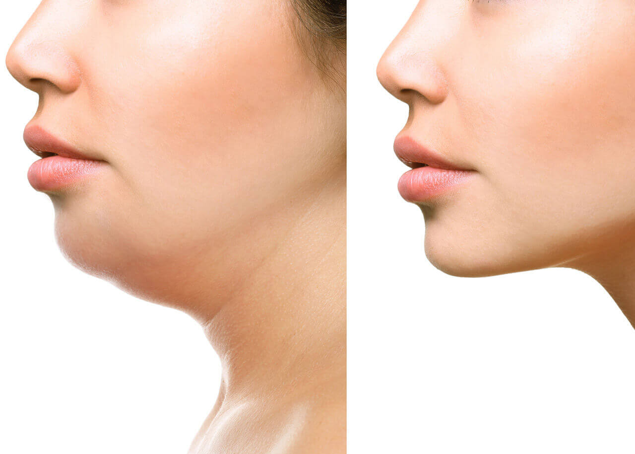 neck