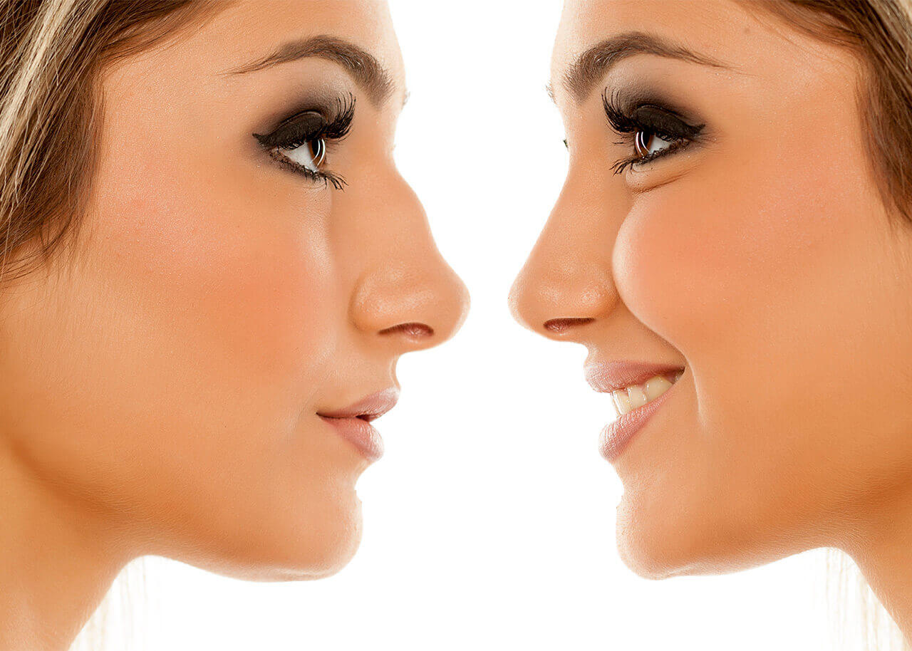 nose