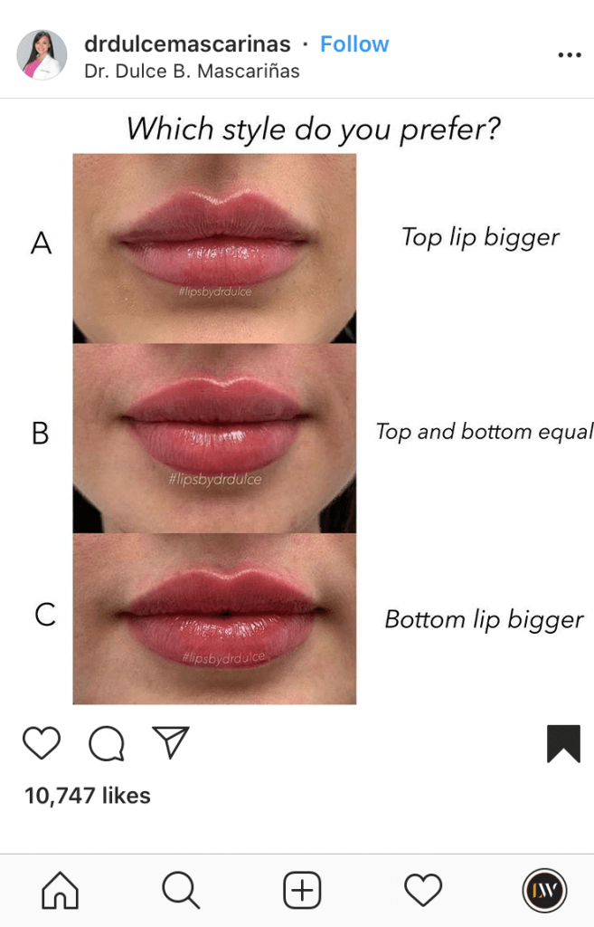 Lets Talk About Lips A Definitive Guide to Lip Fillers