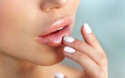 Lets Talk About Lips- A Definitive Guide to Lip Fillers